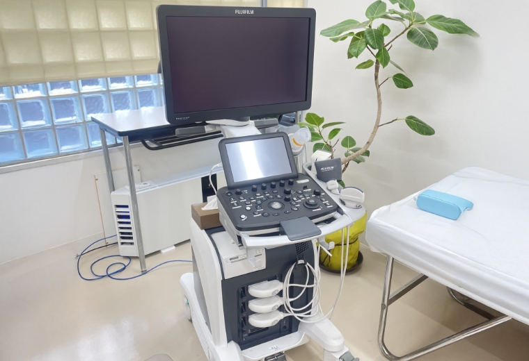 超音波診断装置